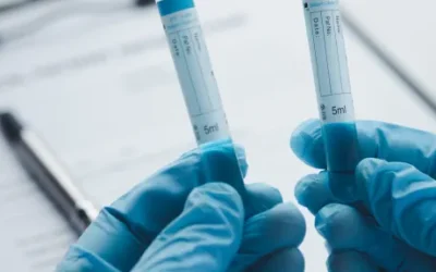 The Critical Function of Drug Screening in Safe and Responsible Recruitment