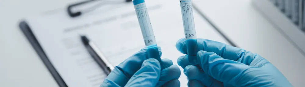 The Critical Function of Drug Screening in Safe and Responsible Recruitment